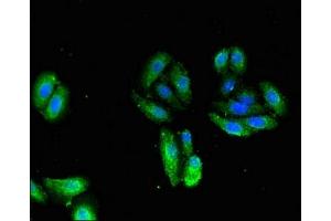 Immunofluorescent analysis of HepG2 cells using ABIN7173582 at dilution of 1:100 and Alexa Fluor 488-congugated AffiniPure Goat Anti-Rabbit IgG(H+L) (TNNI1 Antikörper  (AA 2-173))