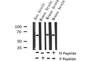 Western blot analysis of Phospho-p62 Dok (Tyr362) expression in various lysates (DOK1 Antikörper  (pTyr362))
