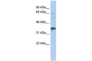 WB Suggested Anti-UBAC2 Antibody Titration: 0. (UBAC2 Antikörper  (Middle Region))