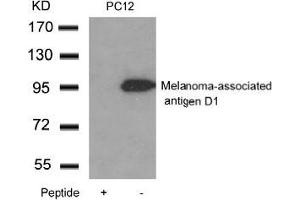 Western blot analysis of extracts from PC12 cells using Melanoma-associated antigen D1and the same antibody preincubated with blocking peptide.