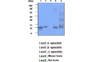 The recombinant human synuclein family (alpha-,beta- and gamma-) (each 20ng), Mouse brain and Rat brain (30 ug) were resolved by SDS-PAGE, transferred to PVDF membrane and probed with anti-human alpha,beta-synuclein (1:1000). (alpha (AA 119-140) Antikörper)