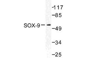 Image no. 1 for anti-SRY (Sex Determining Region Y)-Box 9 (SOX9) antibody (ABIN272082) (SOX9 Antikörper)