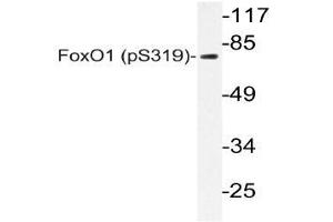 Western blot (WB) analyzes of p-FoxO1 antibody in extracts from 293 SERUM cells. (FOXO1 Antikörper  (pSer319))