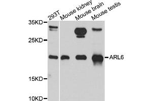 Western blot analysis of extracts of various cell lines, using ARL6 antibody. (ARL6 Antikörper)
