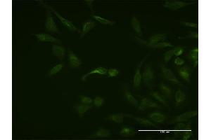 Immunofluorescence of monoclonal antibody to ASB3 on HeLa cell. (ASB3 Antikörper  (AA 1-518))