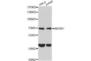 Western blot analysis of extracts of various cell lines, using MUS81 antibody (ABIN2563983) at 1:1000 dilution. (MUS81 Antikörper)