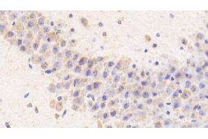 Detection of CTSD in Mouse Cerebellum Tissue using Polyclonal Antibody to Cathepsin D (CTSD) (Cathepsin D Antikörper  (AA 66-410))