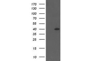 Western Blotting (WB) image for anti-HSPA Binding Protein, Cytoplasmic Cochaperone 1 (HSPBP1) antibody (ABIN1498760) (HSPBP1 Antikörper)