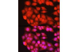 Immunofluorescence analysis of HeLa cells using TRIM63 Rabbit pAb (ABIN3017372, ABIN3017373, ABIN3017374 and ABIN6220060) at dilution of 1:200 (40x lens). (TRIM63 Antikörper)