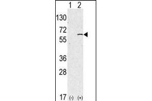 Western Blotting (WB) image for anti-Sphingosine Kinase 1 (SPHK1) (AA 1-30), (N-Term) antibody (ABIN391345)