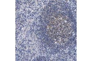 Immunohistochemical staining of human lymph node with LRMP polyclonal antibody  shows moderate cytoplasmic positivity in reaction center cells at 1:500-1:1000 dilution. (LRMP Antikörper)