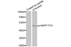 Western blot analysis of extracts from mouse brain tissue using Phospho-MAPT-T231 antibody (ABIN2988163). (MAPT Antikörper  (pThr231))