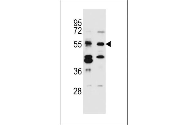 CELF3 Antikörper  (N-Term)