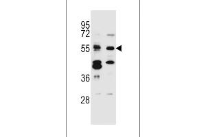 TNRC4 Antibody (N-term) (ABIN657011 and ABIN2846191) western blot analysis in Jurkat,MDA-M cell line lysates (35 μg/lane). (CELF3 Antikörper  (N-Term))