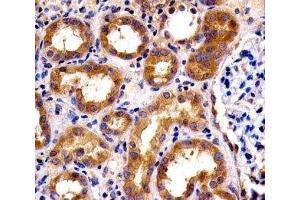 IHC analysis of FFPE human kidney section using SPHK1 antibody; Ab was diluted at 1:100. (SPHK1 Antikörper  (AA 59-89))