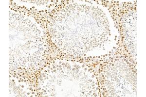 ABIN7094797 and ABIN7098848 at 1/100 staining Rat testis tissue by IHC-P. (TIMD4 Antikörper  (Internal Region))