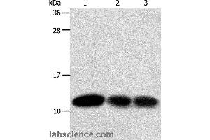 Western blot analysis of Hela and MCF7 cell, human liver cancer tissue, using TXN Polyclonal Antibody at dilution of 1:600