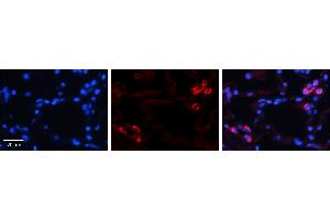 Immunohistochemistry (IHC) image for anti-Insulin-Like Growth Factor Binding Protein 7 (IGFBP7) (C-Term) antibody (ABIN2773913) (IGFBP7 Antikörper  (C-Term))