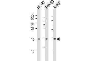 All lanes : Anti-KISS1 Antibody (C-Term) at 1:2000 dilution Lane 1: HL-60 whole cell lysates Lane 2: S whole cell lysates Lane 3: Jurkat whole cell lysates Lysates/proteins at 20 μg per lane. (KISS1 Antikörper  (AA 115-145))