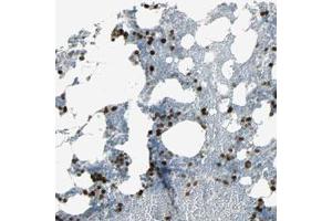 Immunohistochemical staining (Formalin-fixed paraffin-embedded sections) of human bone marrow with TPX2 polyclonal antibody  shows strong nuclear positivity in bone marrow poietic cells. (TPX2 Antikörper)