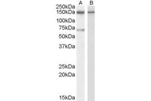 Image no. 1 for anti-Acetylcholinesterase (AChE) (AA 601-614) antibody (ABIN296619) (Acetylcholinesterase Antikörper  (AA 601-614))