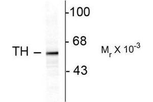 Image no. 1 for anti-Tyrosine Hydroxylase (TH) antibody (ABIN372735) (Tyrosine Hydroxylase Antikörper)