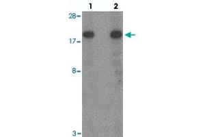 Western blot analysis of TSC22D3 in human small intestine tissue with TSC22D3 polyclonal antibody  at (lane 1) 1 and (lane 2) 2 ug/mL. (TSC22D3 Antikörper  (N-Term))