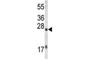 Western blot analysis of EIF4E antibody and HL-60 lysate. (EIF4E Antikörper)