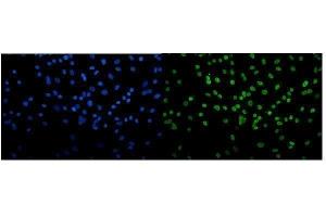 IF analysis of Transketolase/TKT using anti-Transketolase/TKT antibody (ABIN7598958). (TKT Antikörper  (AA 1-116))