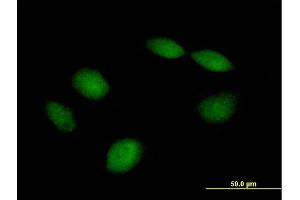 Immunofluorescence of purified MaxPab antibody to PHF21B on HeLa cell. (PHF21B Antikörper  (AA 1-531))
