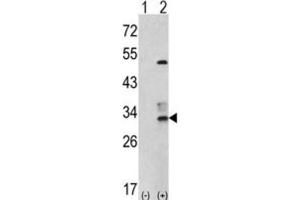 Western Blotting (WB) image for anti-Capping Protein (Actin Filament) Muscle Z-Line, beta (CAPZB) antibody (ABIN3001693) (CAPZB Antikörper)