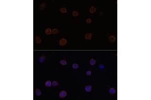 Immunofluorescence analysis of Y79 cells using  Polyclonal Antibody (ABIN6129705, ABIN6136904, ABIN6136906 and ABIN6220328) at dilution of 1:100 (40x lens). (Anoctamin 2 Antikörper  (AA 1-200))