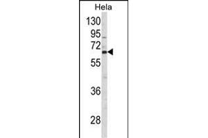 Western blot analysis of CTPS2 Antibody (N-term) (ABIN652725 and ABIN2842481) in Hela cell line lysates (35 μg/lane). (CTPS2 Antikörper  (N-Term))