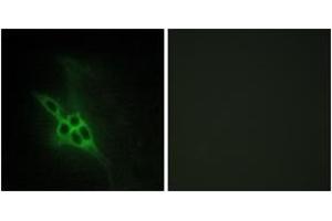 Immunofluorescence analysis of NIH-3T3 cells, using EPHB1/2/3 Antibody. (EPH Receptor B1/2/3 (AA 631-680) Antikörper)