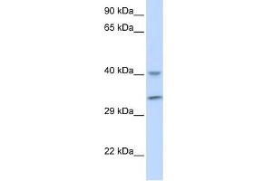 WB Suggested Anti-ALKBH3 Antibody Titration: 0. (ALKBH3 Antikörper  (Middle Region))