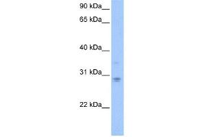 WB Suggested Anti-DCUN1D3 Antibody Titration: 0. (DCUN1D3 Antikörper  (C-Term))