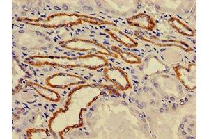 Immunohistochemistry of paraffin-embedded human kidney tissue using ABIN7175212 at dilution of 1:100 (ATP6VA1 (AA 80-260), (Isoform 1) Antikörper)