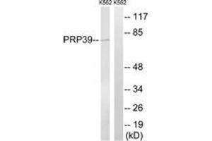 Western blot analysis of extracts from K562 cells, using PRPF39 Antibody. (PRPF39 Antikörper  (AA 263-312))