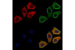 ABIN6261855 and ABIN6272633 staining HepG2 cells by IF/ICC. (GABARAPL2 Antikörper  (N-Term))