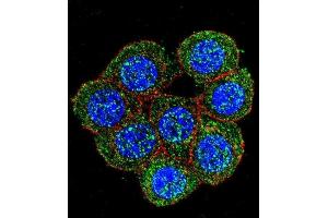 Confocal immunofluorescent analysis of PTK2 Antibody (C-term) (ABIN652554 and ABIN2842372) with 293 cell followed by Alexa Fluor 488-conjugated goat anti-rabbit lgG (green). (FAK Antikörper  (C-Term))