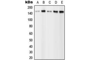 Western blot analysis of PLC gamma 2 (pY1217) expression in HEK293T EGF-treated (A), A431 (B), NIH3T3 (C), SP2/0 EGF-treated (D), H9C2 EGF-treated (E) whole cell lysates. (Phospholipase C gamma 2 Antikörper  (C-Term, pTyr1217))