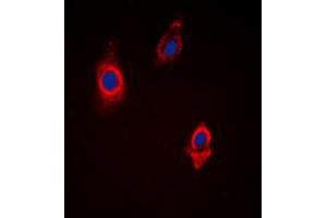 Immunofluorescent analysis of Vinculin staining in HepG2 cells.