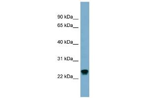 WB Suggested Anti-RAB22A Antibody Titration: 0.