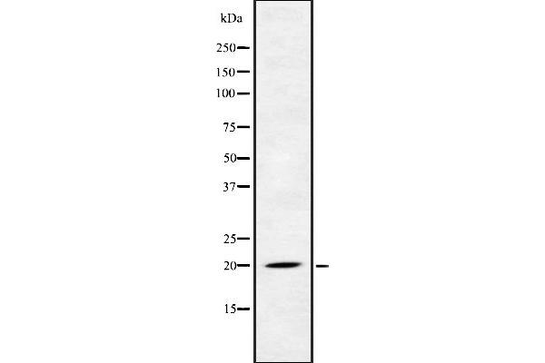 FGF22 Antikörper  (Internal Region)