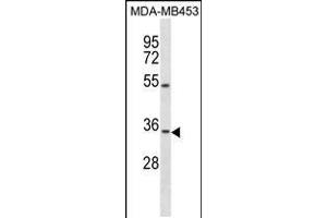 Western blot analysis in MDA-MB453 cell line lysates (35ug/lane). (OSTM1 Antikörper  (C-Term))