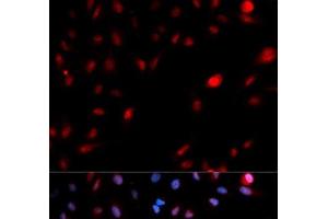 Immunofluorescence analysis of MCF-7 cells using Phospho-CDK1(Y15) Polyclonal Antibody (CDK1 Antikörper  (pTyr15))