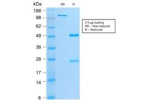 SDS-PAGE analysis of purified, BSA-free recombinant MyoD antibody (clone MYOD1/2075R) as confirmation of integrity and purity.