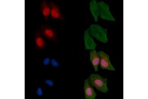 ABIN6256439 and ABIN6267582 staining Hela cells by IF/ICC.