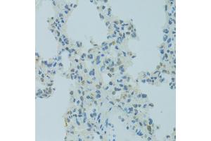 Immunohistochemistry of paraffin-embedded rat lung using MBD2 antibody (ABIN1873650) at dilution of 1:100 (40x lens).