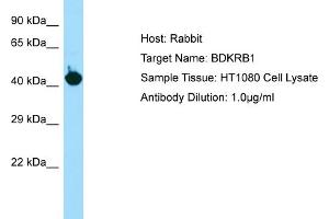 Host: RabbitTarget Name: BDKRB1Antibody Dilution: 1. (BDKRB1 Antikörper  (C-Term))